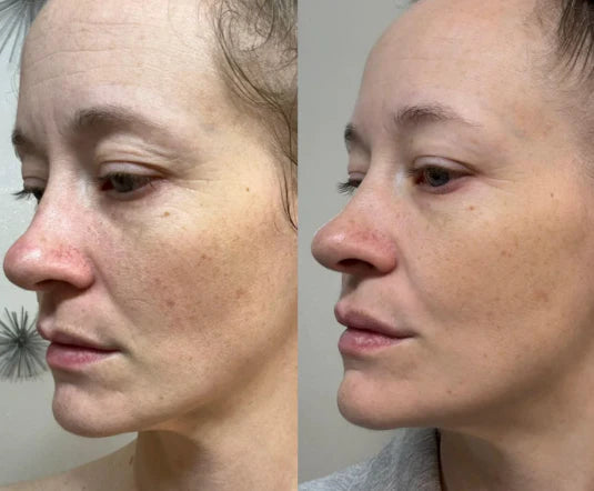 Masajeador y Rejuvenecedor Facial 3 en 1 + ¡REGALO GRATIS!
